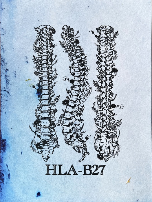 HLA-B287 Mini Limited Edition